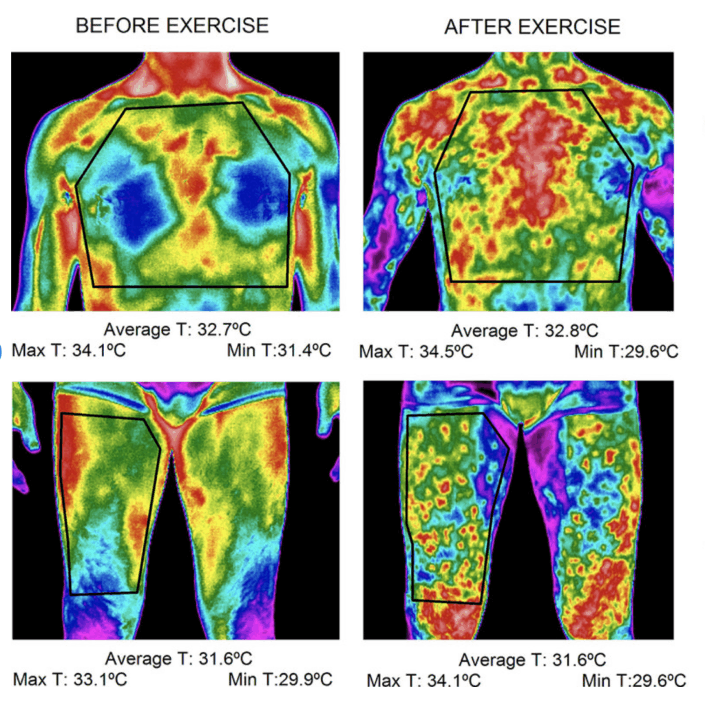 Diagram of improved blood flow under FIR